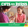 Cuts and Burns