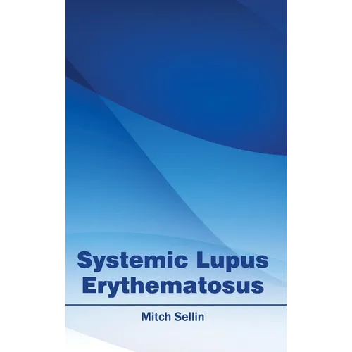 Systemic Lupus Erythematosus