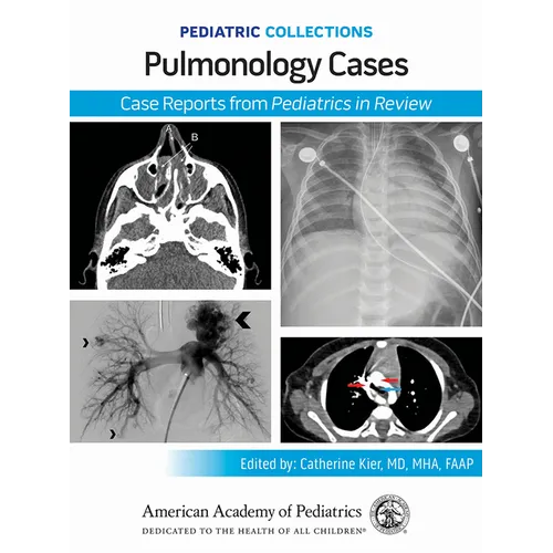 Pediatric Collections: Pulmonology Cases: Case Reports from Pediatrics in Review