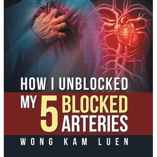 How I Unblocked My 5 Blocked Arteries
