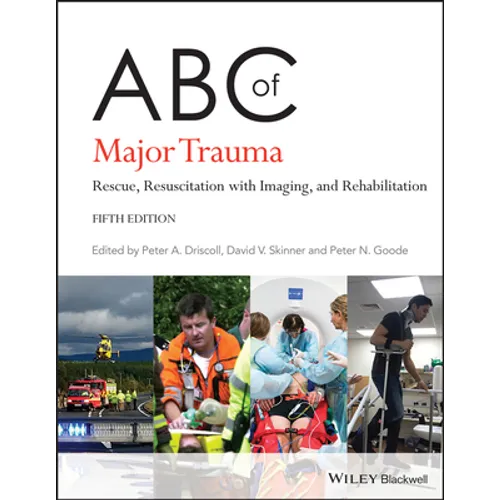 ABC of Major Trauma: Rescue, Resuscitation with Imaging, and Rehabilitation