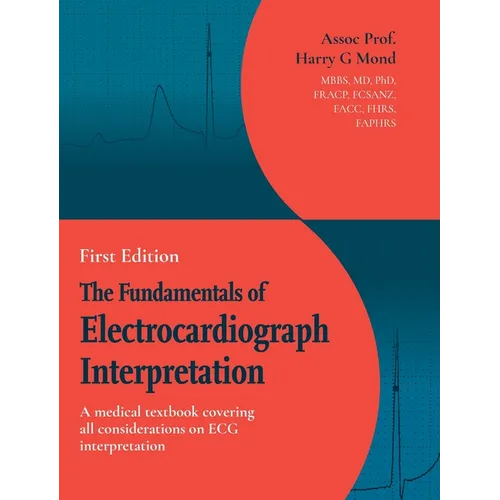 The Fundamentals of Electrocardiograph Interpretation: A medial textbook covering all considerations on ECG interpretation