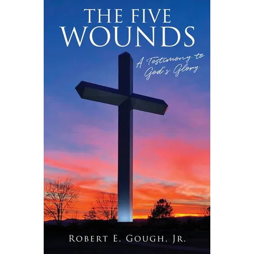 The Five Wounds: A Testimony to God's Glory