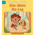 Sim Skins His Leg