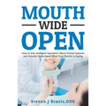 Mouth Wide Open: How To Ask Intelligent Questions About Dental Implants and Actually Understand What Your Dentist Is Saying