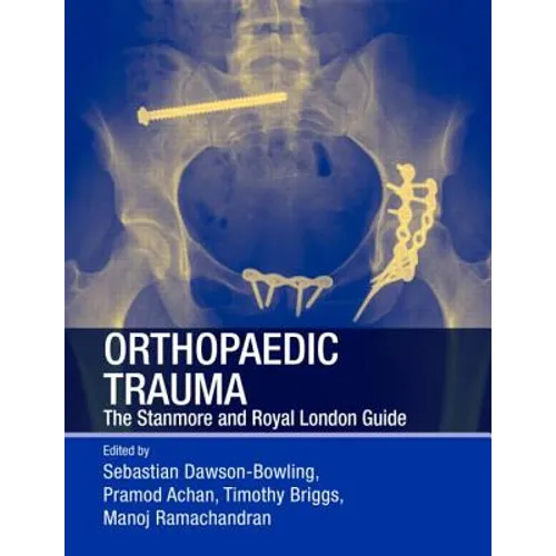 Orthopaedic Trauma: The Stanmore and Royal London Guide