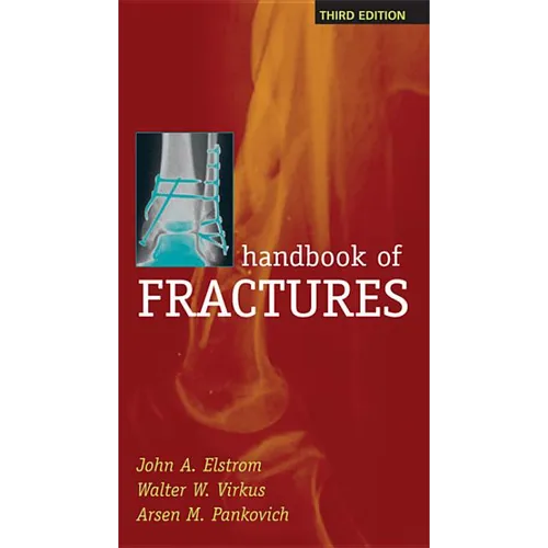 Handbook of Fractures, Third Edition