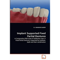 Implant Supported Fixed Partial Dentures