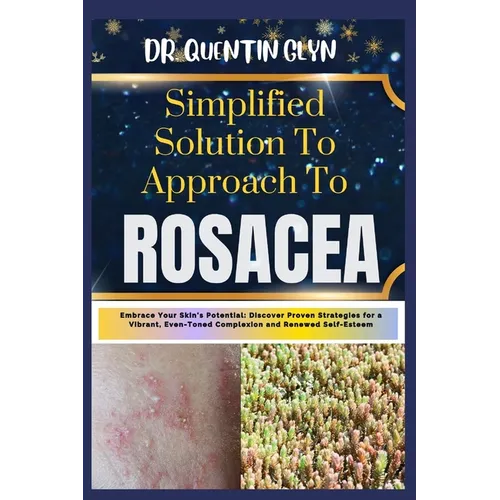 Simplified Solution Approach To ROSACEA: Embrace Your Skin's Potential: Discover Proven Strategies for a Vibrant, Even-Toned Complexion and Renewed Se