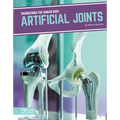 Artificial Joints