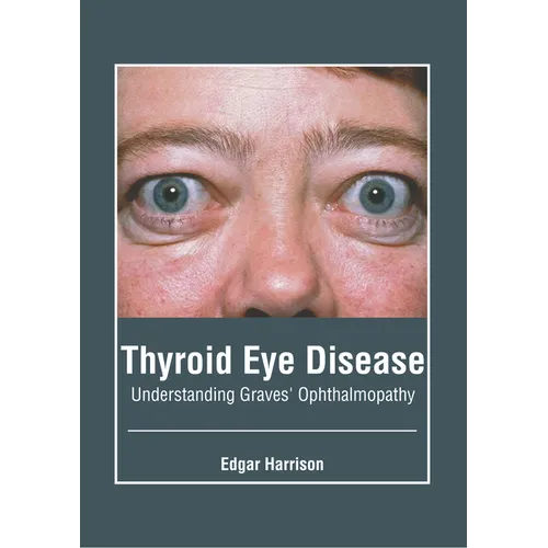 Thyroid Eye Disease: Understanding Graves' Ophthalmopathy