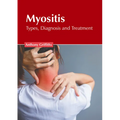 Myositis: Types, Diagnosis and Treatment