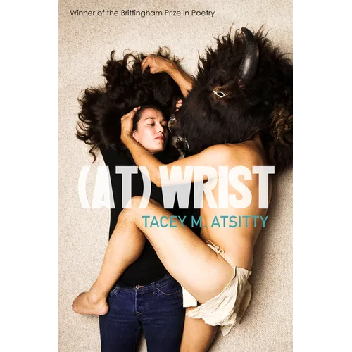 (At) Wrist