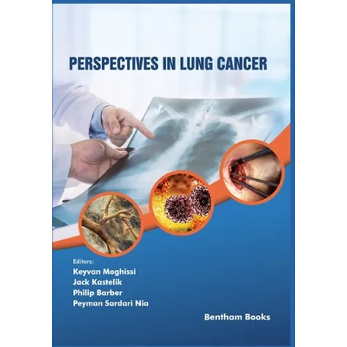 Perspectives in Lung Cancer - Paperback