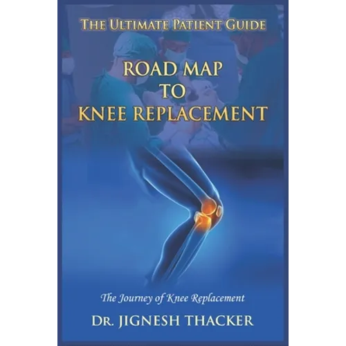 Road Map to Knee Replacement: The Journey Of Knee Replacement, Ultimate Patient Guide