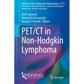 Pet/CT in Non-Hodgkin Lymphoma