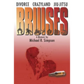 Bruises