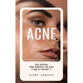 Acne: Proven Natural Remedies for Acne-free Skin (Easy Natural Home Remedies for Acne & How to Prevent It)