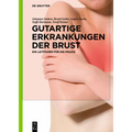 Gutartige Erkrankungen Der Brust: Ein Leitfaden Für Die PRAXIS