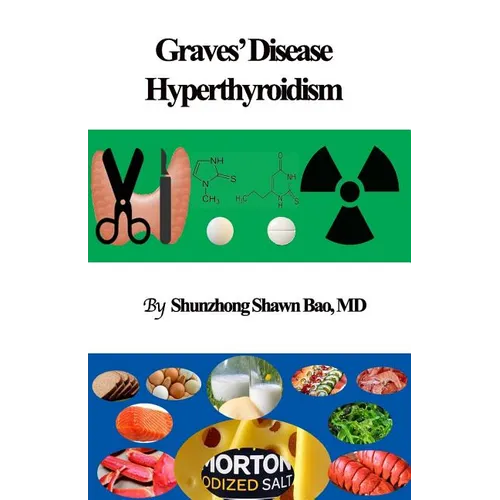 Graves' Disease and Hyperthyroidism: Questions and Answers