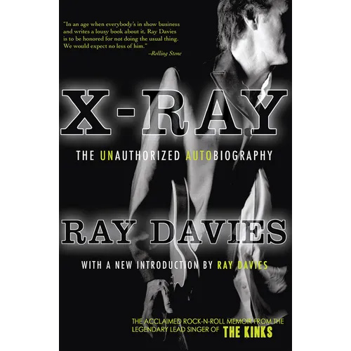 X-Ray: The Unauthorized Autobiography: A Speculative Memoir of the Kinks and the Death of the Sixties