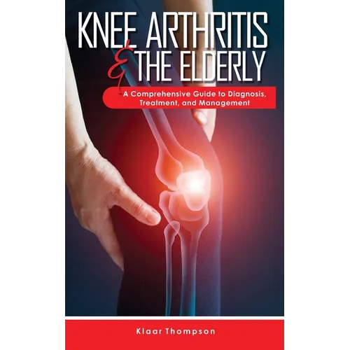 Knee Arthritis &The Elderly: A Comprehensive Guide to Diagnosis, Treatment, and Management