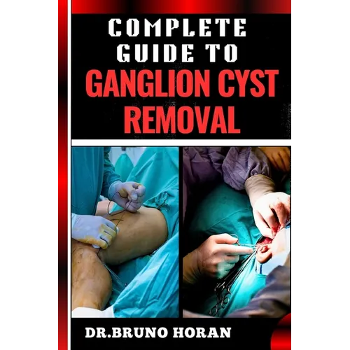 Complete Guide to Ganglion Cyst Removal: Comprehensive Handbook To Expert Techniques, Home Remedies, And Post Surgery Care For Pain Relief And Healing