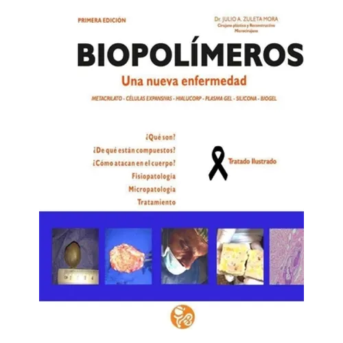 Biopolimeros: Una nueva enfermedad