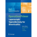 Laparoscopic Sigmoidectomy for Diverticulitis