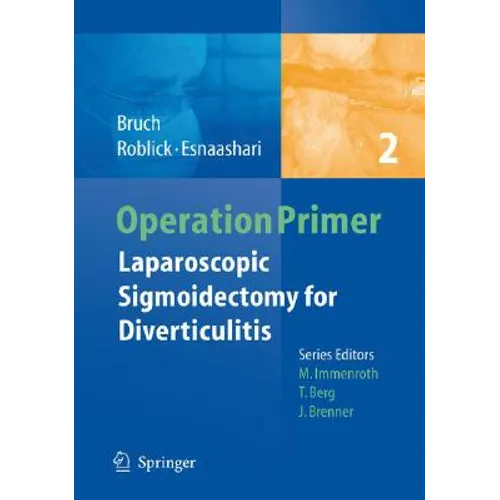 Laparoscopic Sigmoidectomy for Diverticulitis