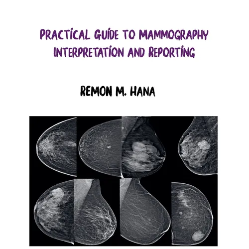 Practical Guide to Mammography Interpretation and Reporting