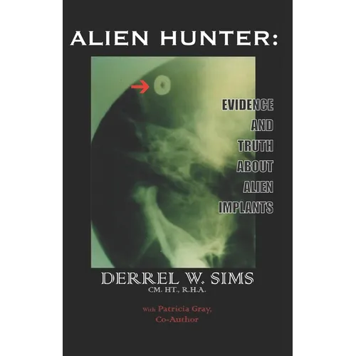 Alien Implants: Evidence & Truth about Alien Implants