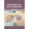 Wound Healing, Tissue Repair and Regeneration