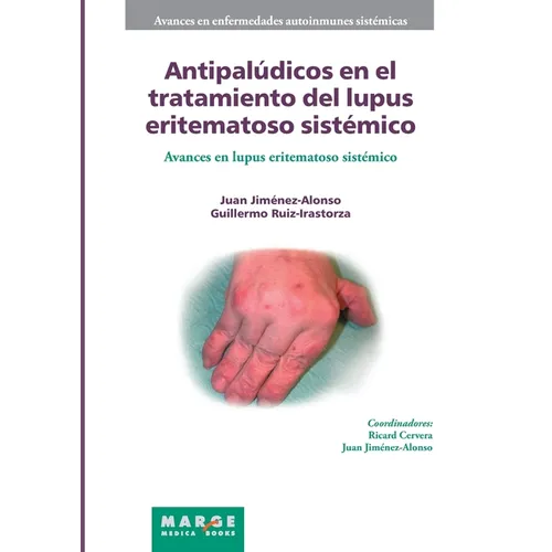 Antipalúdicos en el tratamiento del lupus eritematoso sistémico