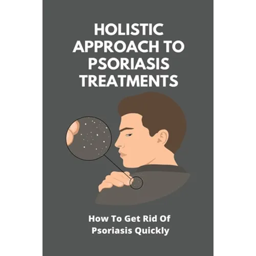 Holistic Approach To Psoriasis Treatments: How To Get Rid Of Psoriasis Quickly: Is Psoriasis Itchy