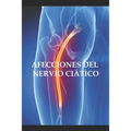 Afecciones del nervio ciático