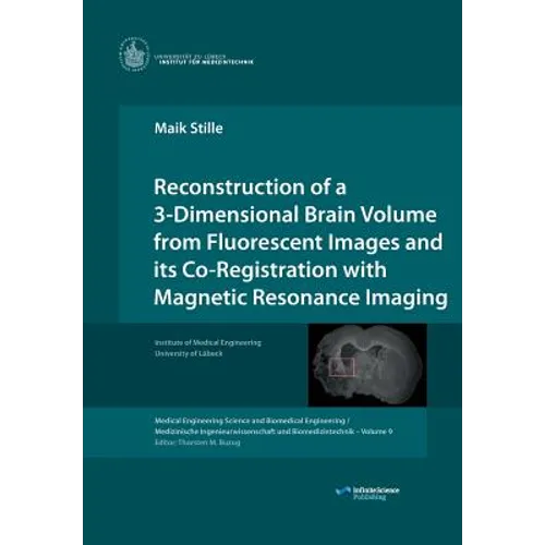 Reconstruction of a 3-Dimensional Brain Volume from Fluorescent Images and its Co-Registration with Magnetic Resonance Imaging