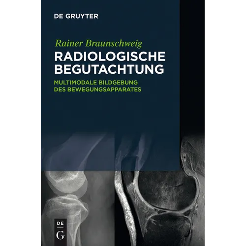 Radiologische Begutachtung: Multimodale Bildgebung Des Bewegungsapparates