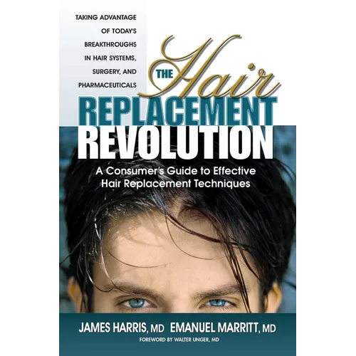 The Hair Replacement Revolution: A Consumer's Guide to Effective Hair Replacement Techniques