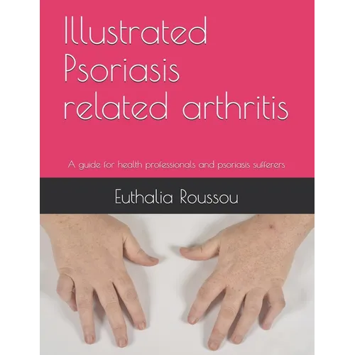 Illustrated Psoriasis related arthritis: A guide for health professionals and psoriasis sufferers