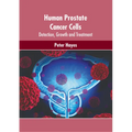 Human Prostate Cancer Cells: Detection, Growth and Treatment