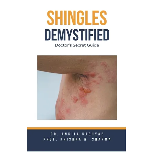 Shingles Demystified: Doctor's Secret Guide