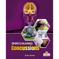 Concussions