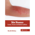 Skin Diseases: Eczema, Psoriasis and Related Conditions