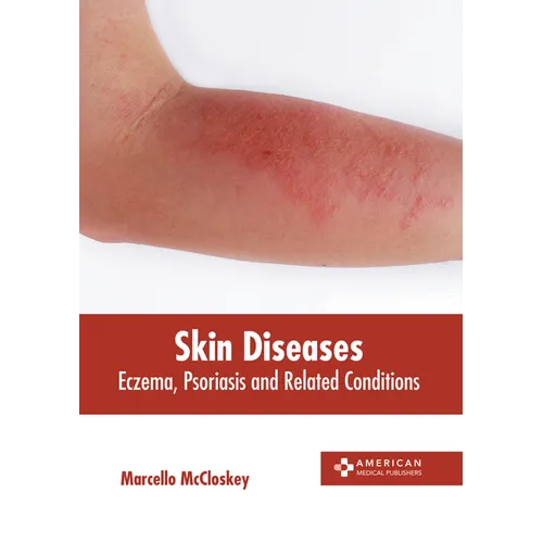 Skin Diseases: Eczema, Psoriasis and Related Conditions