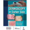 Dermoscopy in Darker Skin