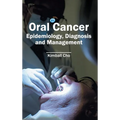 Oral Cancer: Epidemiology, Diagnosis and Management