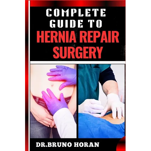 Complete Guide to Hernia Repair Surgery: Comprehensive Handbook To Procedures, Recovery, And Minimizing Complications For Effective Treatment