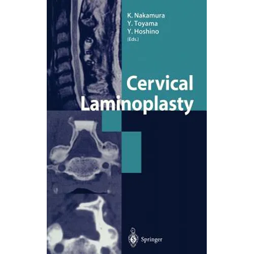 Cervical Laminoplasty