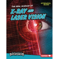 The Real Science of X-Ray and Laser Vision